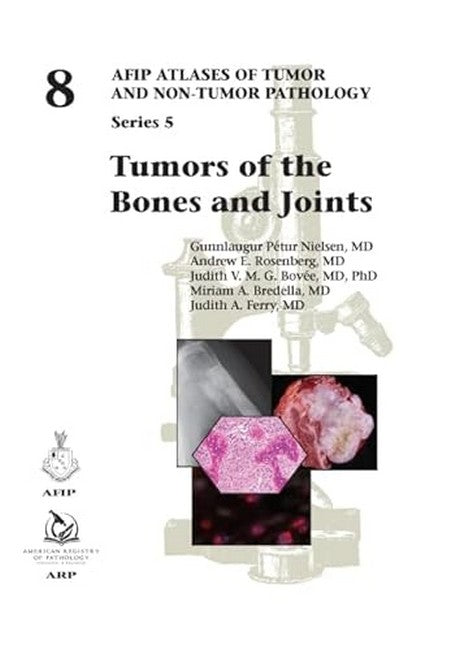 Tumors of the Bones and Joints