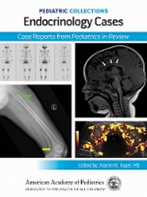 Endocrinology Cases