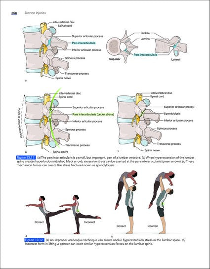 Dance Injuries