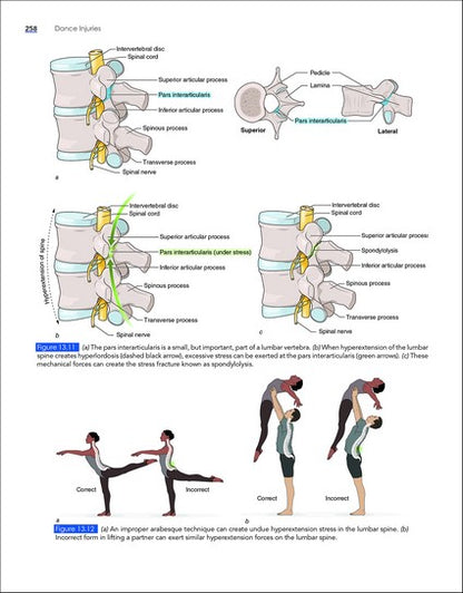 Dance Injuries