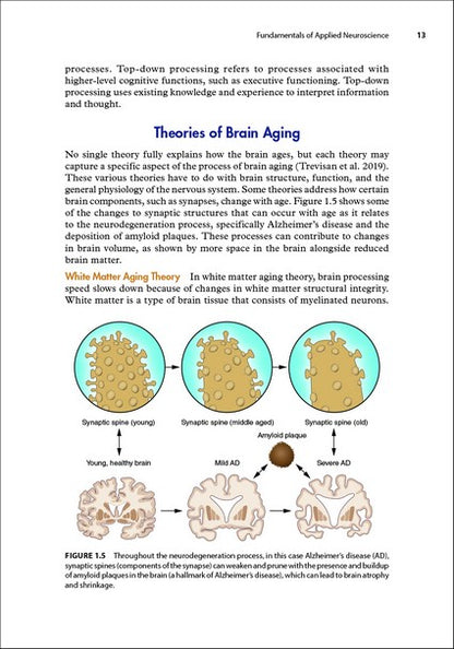 Brain Health and Exercise