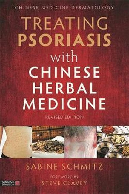 Treating Psoriasis with Chinese Herbal Medicine (Revised Edition): A Pra