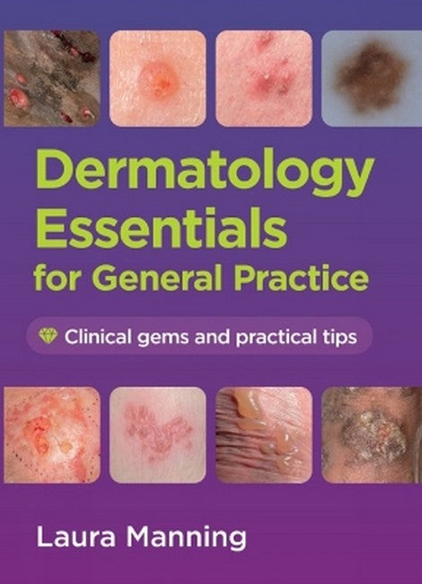 Dermatology Essentials for General Practice
