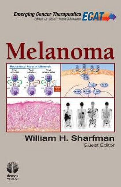 Melanoma